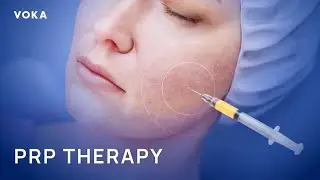 PRP Explained: The Science of Skin & Hair Regeneration in 3D Animation