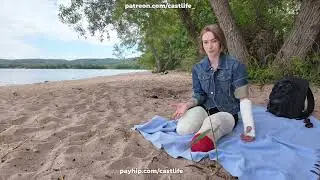 Girl double leg amputee, arm cast, she rest on the beach, lying in bed and first wheelchair ride
