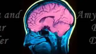 BSCI446  Amygdala in Fear Responses and Bipolar Disorder