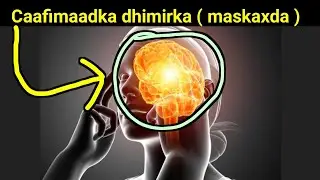 caafimaadka dhimirka ( maskaxda ) 8-daan sheey ku dadaal ❣️✅