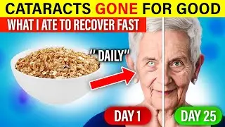 Top 5 Grains To Reverse Cataracts & Glaucoma - Dr. Neal Adams