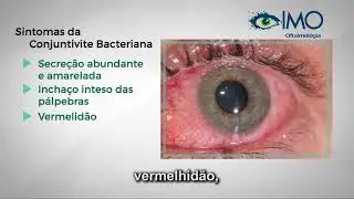 IMO - Conjuntivite bacteriana