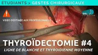 Comment réaliser une thyroïdectomie | #4 Ouverture de la ligne blanche | Formation chirurgie ORL