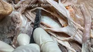 SPINAL ACCESSORY VAGUS HYPOGLOSSAL GLOSSOPHARYNGEAL Nerves in Neck with Clinicals – Sanjoy Sanyal