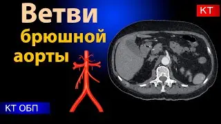Radial anatomy of the branches of the abdominal aorta.