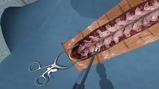 Spinal Pedicle Screw - VR Simulation