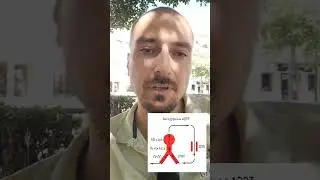 Антидромные АВРТ 