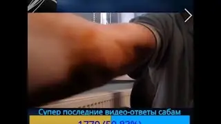 Роздулась вена, у папича синяк на вене