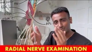 Radial Nerve Exam Made Easy: Peripheral Nerve Specialist’s Step-by-Step Tutorial with Top Tips