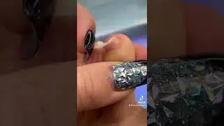 Why do you need LONG FOOTNAILS? Ingrown nail. The corners of your toes hurt. How to cut your nail...