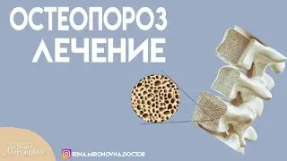 Остеопороз. Лечение.
