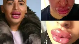 Фанаты, которые сделали операции, чтобы стать похожими на знаменитостей!
