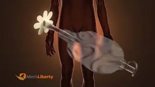 Men's Liberty Application Video