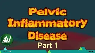 Pelvic inflammatory disease Masterclass Parrt 1