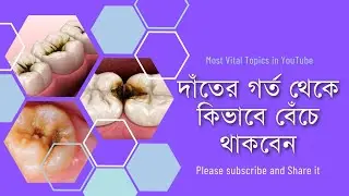 দাঁতের গর্ত থেকে বাঁচার উপায় @DentalHealthTips