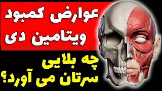 کمبود ویتامین d | عوارض کمبود ویتامین دی