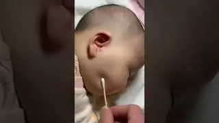 cute baby#shorts