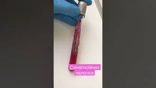 Синегнойная палочка Pseudomonas aeruginosa - культура бактерии на трехсахарном агаре