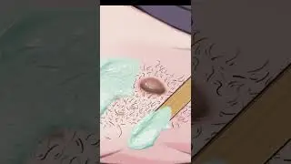 ASMR waxing and acne skin care cartoon |