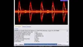 ultrasound sonogram viewer