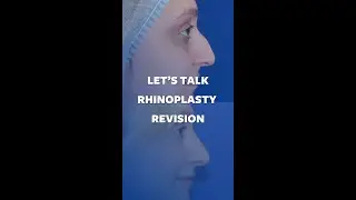 Dr. Yalamanchili Talks About Revision Rhinoplasty