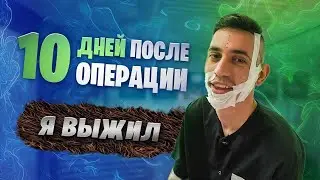 ПЕРЕСАДКА БОРОДЫ. ОТЧЁТ НА 10-Й ДЕНЬ ПОСЛЕ ОПЕРАЦИИv