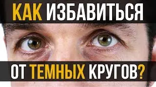 7 советов, как избавиться от темных кругов под глазами