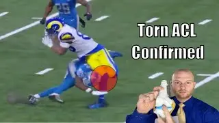 Tyler Higbee Injury Update!  Tyler Higbee Knee Injury Explained