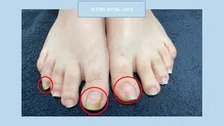 Healthy Vital Nails Lift Patient’s Self-Confidence!
