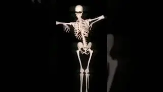 #skeleton EDIT