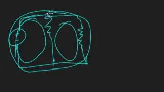 07 Kirchoffs laws KVL KCL