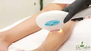 Lazer epilyasiya aparati (Blude Derm)