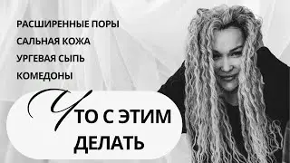 АКНЕ/РАСШИРЕННЫЕ ПОРЫ/КОМЕДОНЫ/САЛЬНАЯ КОЖА/УРГЕВАЯ СЫПЬ ЧТО С ЭТИМ ДЕЛАТЬ