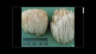 WEBINAR DE LA MELENA DE LEON DR  SAVERA