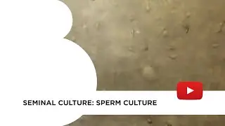 Seminal culture: sperm culture