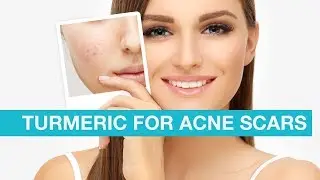 Turmeric for Acne Scars