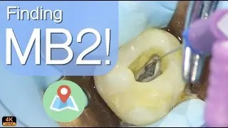 Find MB2 easy! | 4K resolution