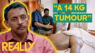 Man Has Had A Huge Tumor On His Thigh For 30 Years! | Body Bizarre