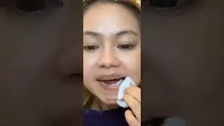 RARA LIDA DI RAWAT DI RUMAH SAKIT CUMA SATU HARI KATA NYA GUYS/SEHAT2 YA RARA