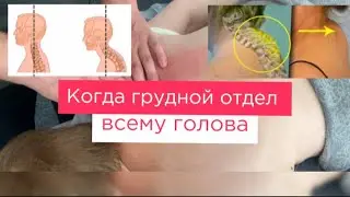 Холка - вершина АЙСБЕРГА! Как убрать блоки в ПОЗВОНОЧНИКЕ? ЛАЙФХАК в диагностике Миопрессура