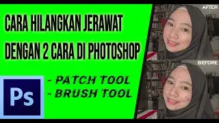 Tutorial | Cara Menghilangkan Jerawat 100% Work - Photoshop Indonesia