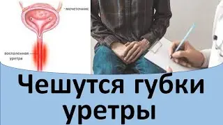 Чешутся губки уретры