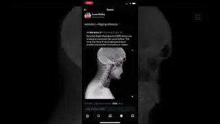 Animation and rigging xray joint placement and pivot reference 