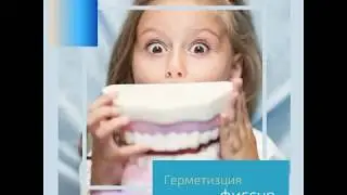 Герметизация фиссур для детей - что это и зачем?