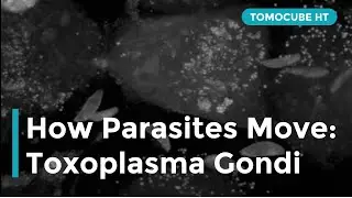 How Parasites Move: Toxoplasma gondii