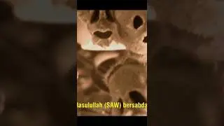 ☝️ Full Video | Buah Zaqqum di dunia