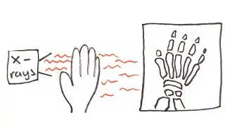 X-Rays | GCSE Physics | Doodle Science