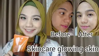 2 MINGGU GLOWING PAKAI COMMONLABS | REVIEW COMMONLABS #commonlabs #skincarekorea