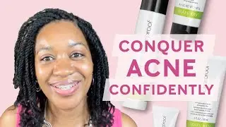 Conquer Acne Confidently | Mary Kay Clear Proof Acne System | Before & After