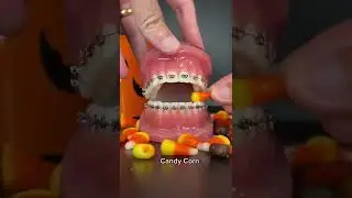 Halloween Candies You can Eat With Braces